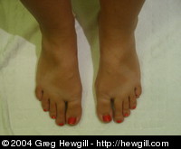 Amy wanted a picture of her zigzag Chaco-tan.